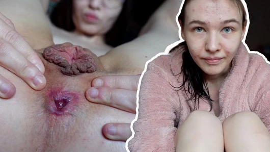 18 yaşındaki çok sıska kız, büyük dudak, küçük memeler sana tüm vücudunu gösteriyor