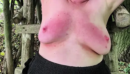 Red breasts with nipple braces