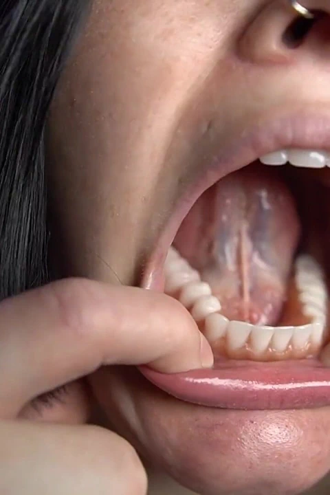 Takma yarakla ağız turu