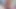 Doktorlar ofisinde Charlotte stokely ve whitney wright patlama