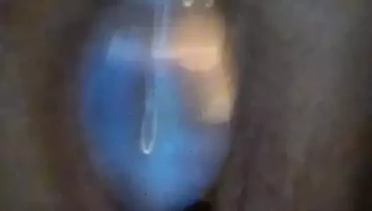 Ben ve incim sızdırıldık