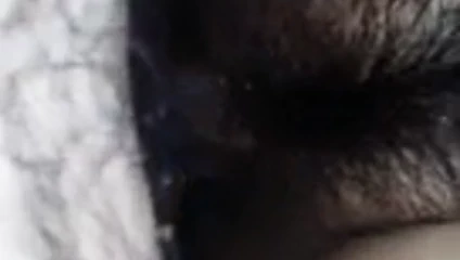 Büyük kore eşi clistoris