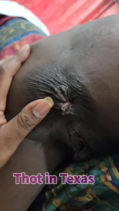 Wore out Asshole Homemade Real Damaged Anus