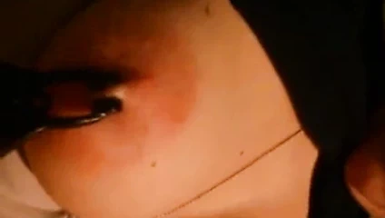 Meme kelepçelerinin çıkarılması