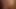 Hoeschen mit Ring
