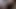Abanoz pov ayak tırnakları