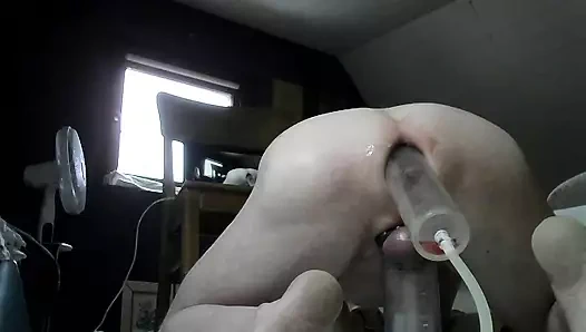 Çift elle ve dev tıkaçla 1. deneme prolapsus pompası