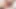 derin anal 2