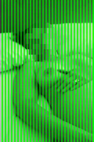 Röntgenci şekerlemesi