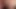anal 2