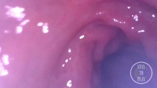 Bakış açısı aşırı derin anal muayene