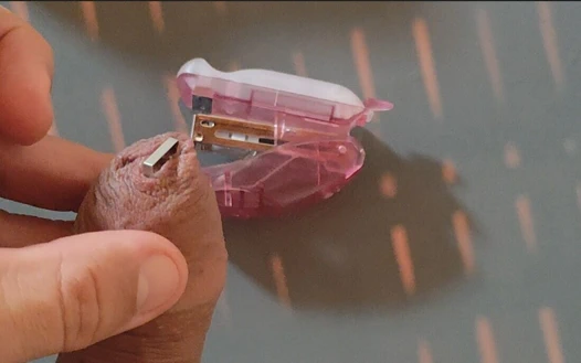 Yoğun Zevk Zımbala Fimozu.