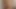 Paris pov sikme ve yüz