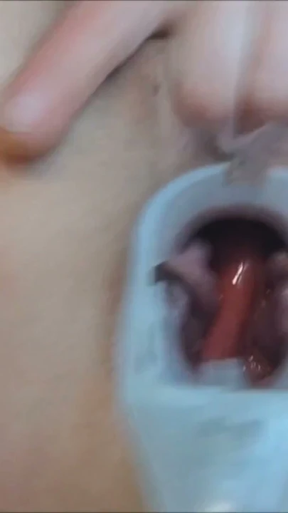 Speculum götümde yakından ve amımla oynuyorum ıslak zonklayan orgazmlar | Bölüm 2