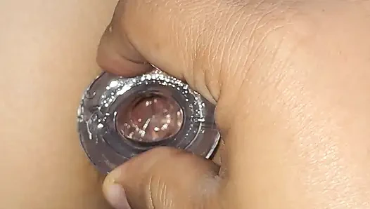 Götünü genişletiyor