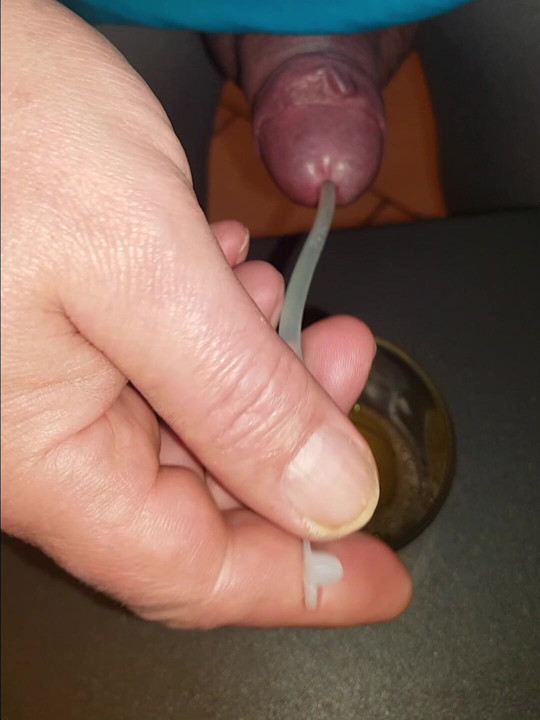 ÜRETRAL SOKMA VE IŞEME