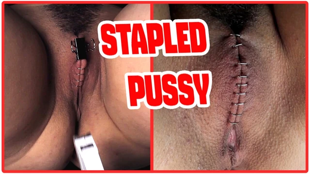 Садистский доктор закрывает и скрепляет киску своей пациентки