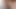 Rulmanlı beş sünnet derisi videosu