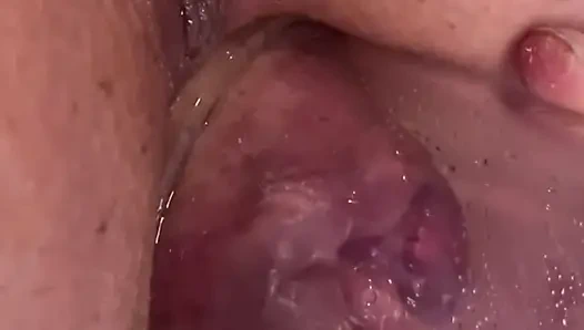 Aşırı anal vakum pompası eğitimi 2025