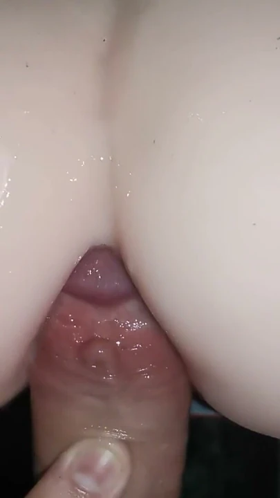 Harika Göt | Bölüm 2