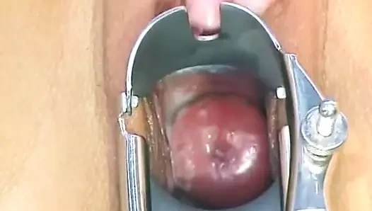 Metal bir spekulum aracılığıyla güzel ve kremsi pembe serviks