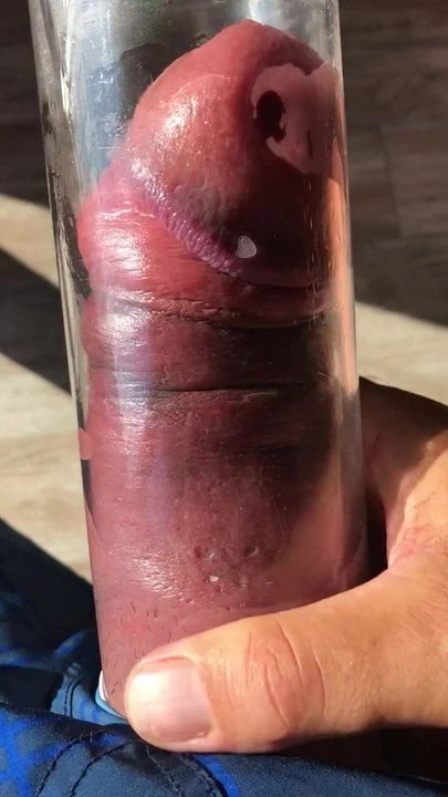 Dev yarak pompalanıyor