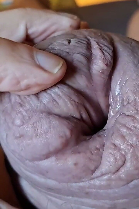Aşırı pompalama!
