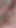 My Lovely Legs | Clip 2