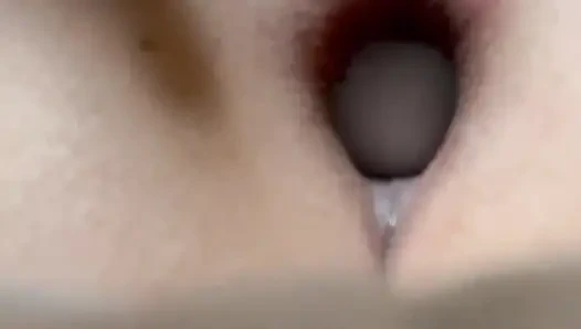 Anüsünde ping pong topu