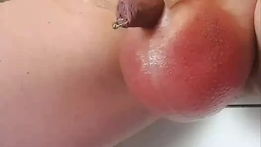 Skrotumda 2l glukoz infüzyon timelapse