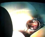 (18)zhangjiajing hemşireleri (tayvan)