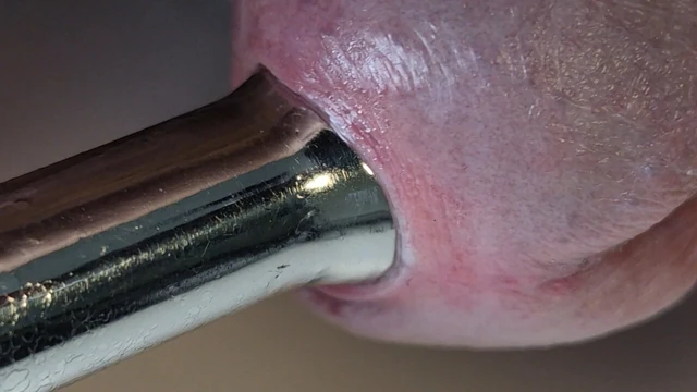 Son derece sıkı 14 mm üretral gözyaşı tıkacı yakın çekim.