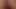 Mikropenis'im
