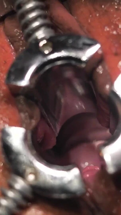 Lady Sonia milf.mp4 için yumruk sokma, medioeval speculum ve orgazm | Klip 1