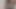 Üvey anne ateşli 31 talimatı veriyor