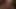 Ömer vs Jenny Mansfield