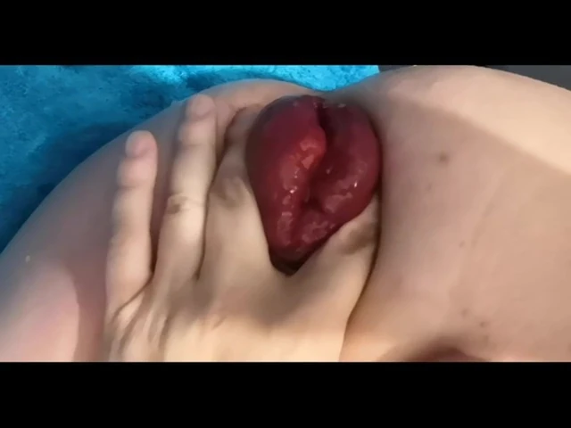 prolapsusu