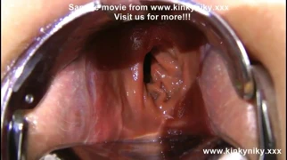 Xo spekulum, derin yapay penis, esneme tarafından seks hizmetçi kinkyniky