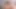 Porno Çekiminde Vadika Kremi Ile Vuruldu