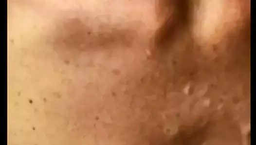 Konchil zhene na sis'ki