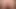 asshole close up
