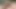 Abspritzer 1