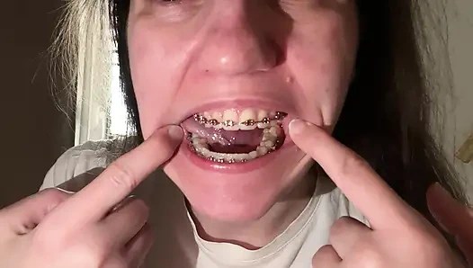 Dilinizle diş teli yalamak