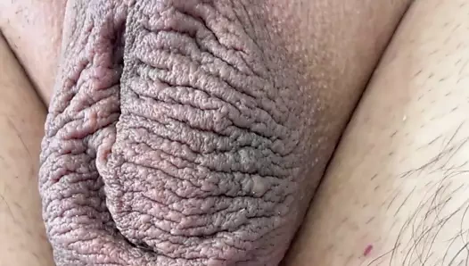 Erkek epilasyonunun sonucu.