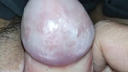 Sünnetik sağ geri çekti ve glans mmm'nin arkasında çalışıyor