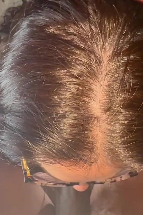 Elegant Nut Extraction