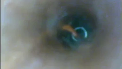 çiş deliğimin içinde