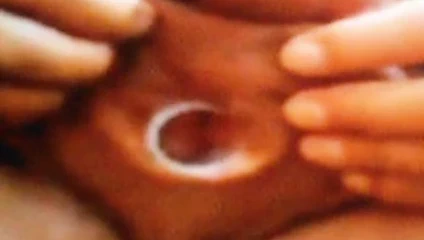 Didi mit rohr 15mm un der Urethra bis un die Blase