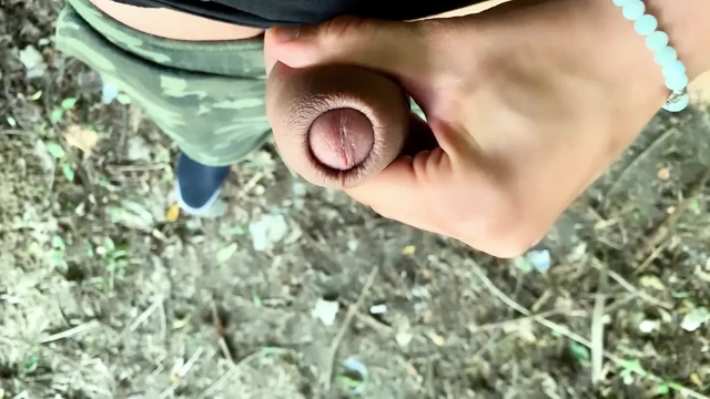 Islak üretrama bak - glans yakın çekim
