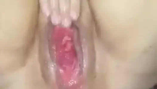 Orgazmdan anal ve vajinal prolapsus